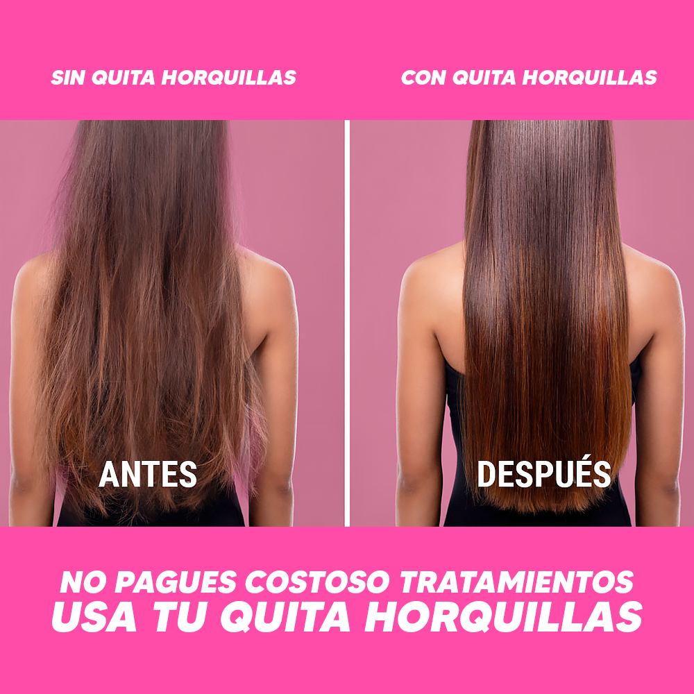 Máquina Quita Horquillas