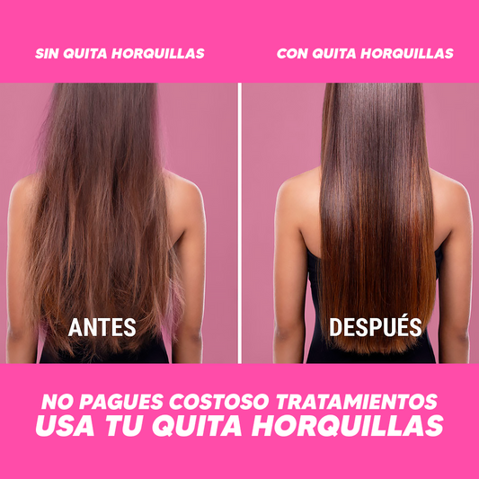 Quita Horquillas Moula